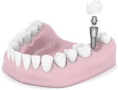 Chandranand Dental Clinic Shreshtha Vihar Delhi
