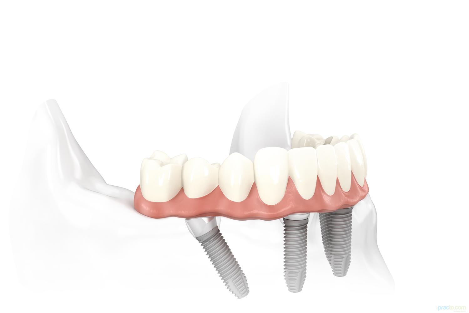 Total Dental Care Raja Park Colony Jaipur