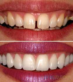 Multi Speciality Dental Clinic Sheikh Sarai Delhi