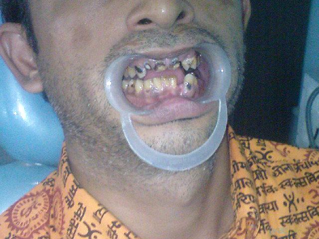 Equipment Area at Vishesh Dental Clinic Dwarka Delhi