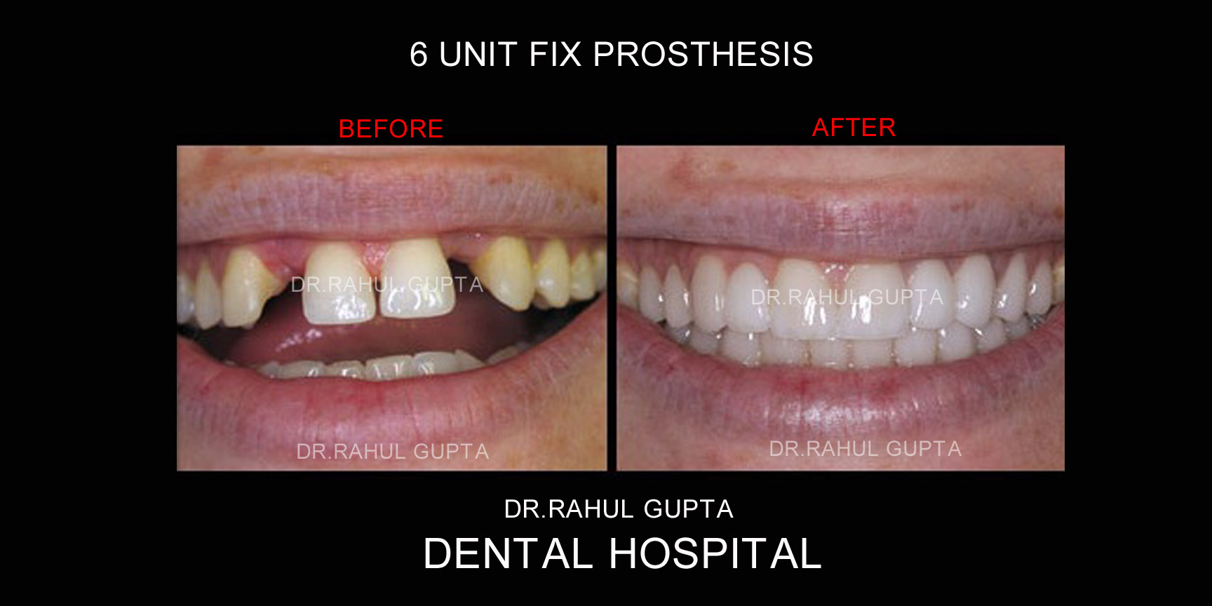 Dr. RAHUL GUPTA DENTAL HOSPITAL Noida Noida