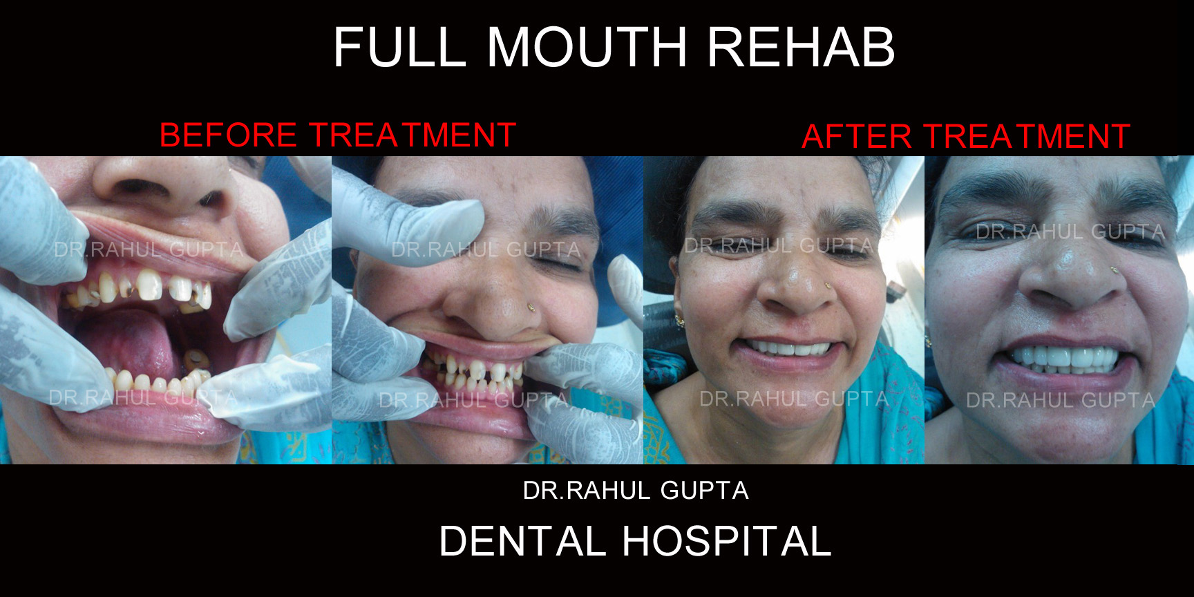 Dr. RAHUL GUPTA DENTAL HOSPITAL Noida Noida