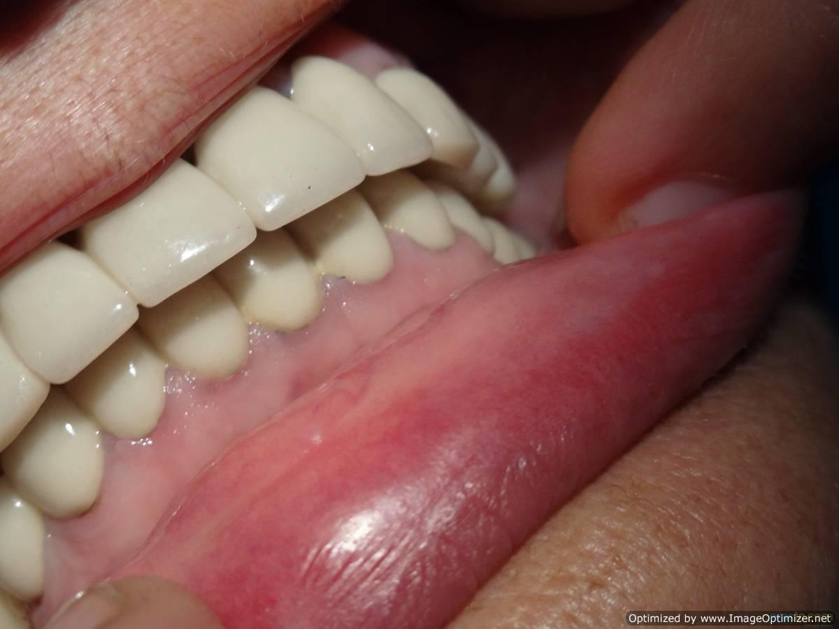 Dr. Bindal's Dental Laser Clinic & Implant Centre Sector-21 Panchkula