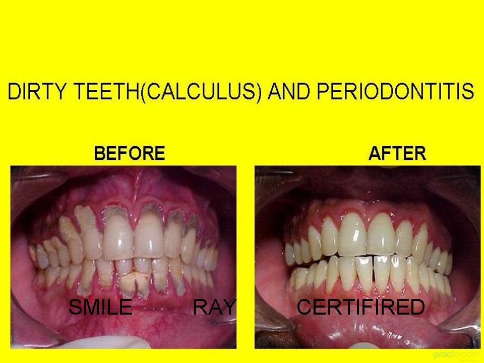 Smile Ray Superspeciality Dental Clinic Swaroop Nagar Kanpur