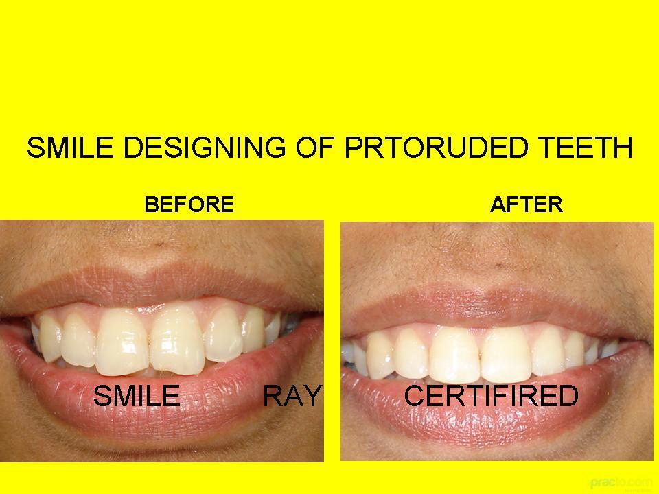 Smile Ray Superspeciality Dental Clinic Swaroop Nagar Kanpur