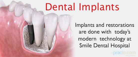 smile dental hospital Mehdipatnam Hyderabad