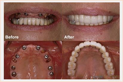 Lokpriya Dental Clinic Allahabad Allahabad