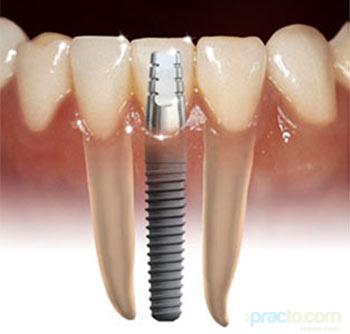 Lokpriya Dental Clinic Allahabad Allahabad
