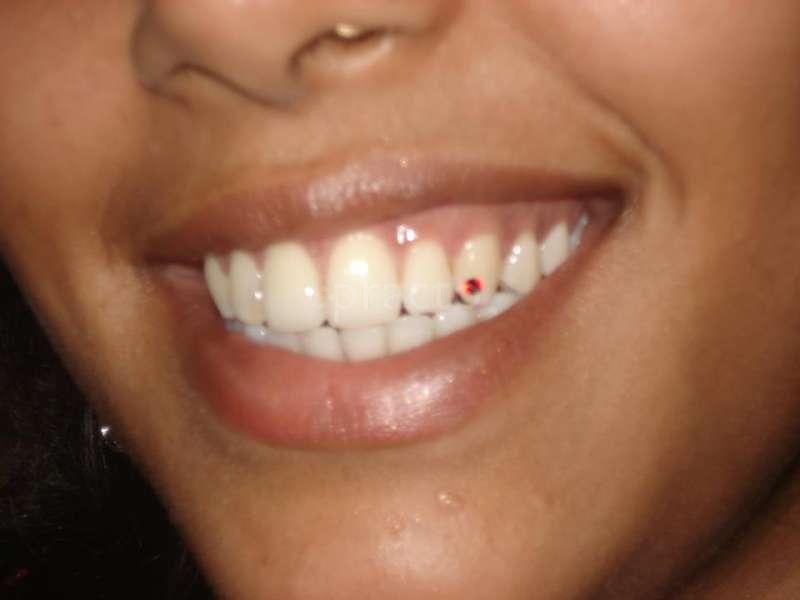 Dandelion Dental & Derma Care Centre Andheri West Mumbai