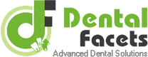 Dental Facets