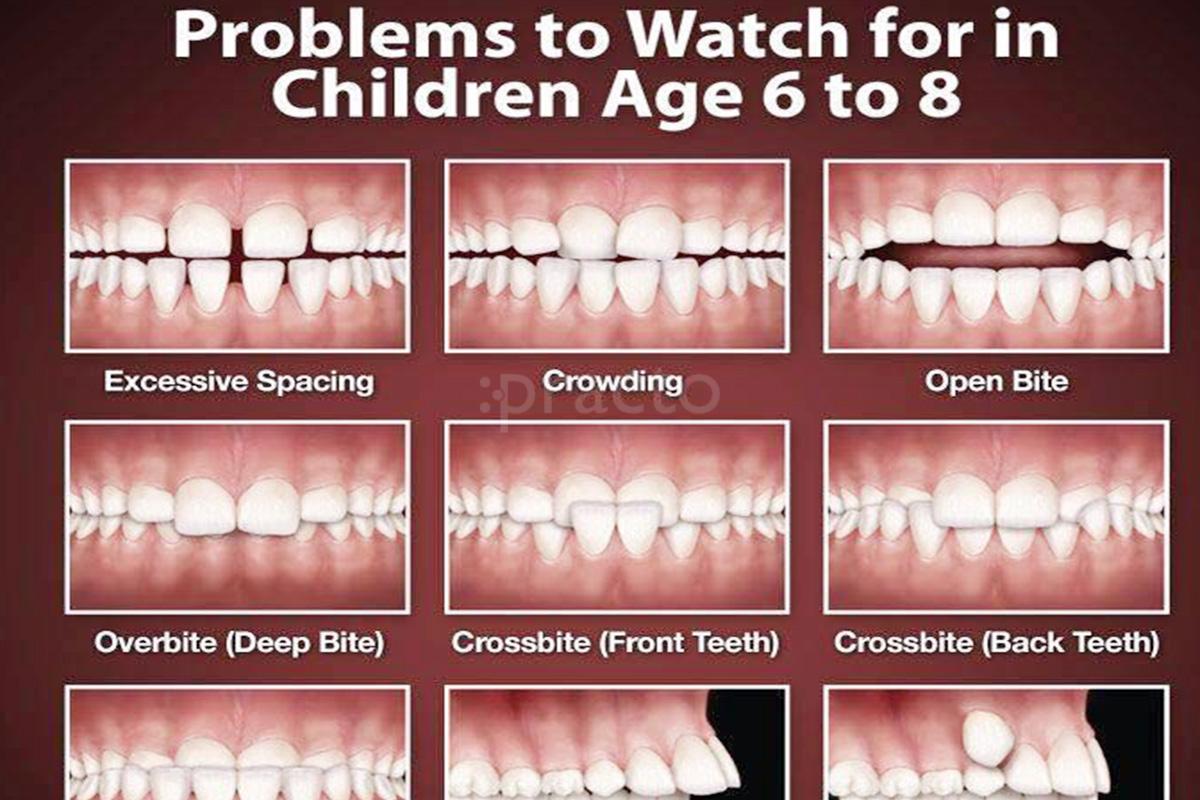 Others at Dental Relief & Orthodontics Shahdara Delhi