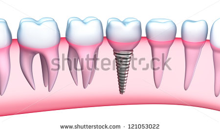 Dr. Agale's Multispeciality Dental Clinic