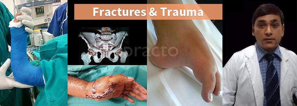 Arthritis Clinic Green Field Colony Faridabad