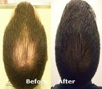 Dr Geeta Gera Skin Clinic Indirapuram Ghaziabad