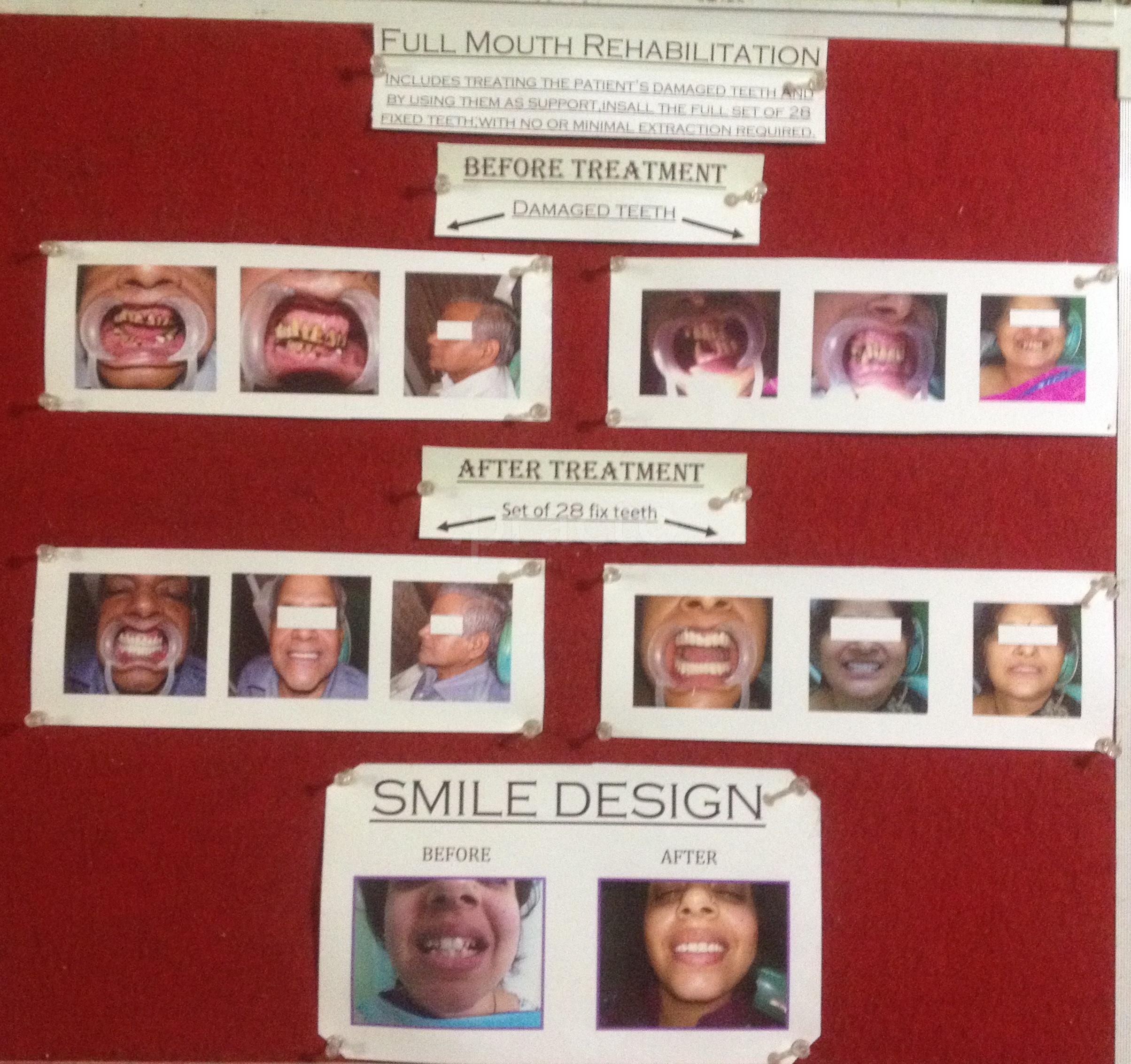 Krishna Dental Clinic Shalimar Garden Ghaziabad