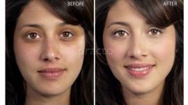 Dr. Priya's Anti Aging Clinic Chinna Waltair Visakhapatnam