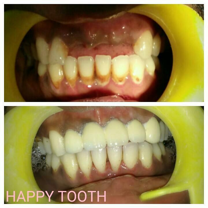 Happy Tooth Multispeciality Dental Clinic Sion West Mumbai