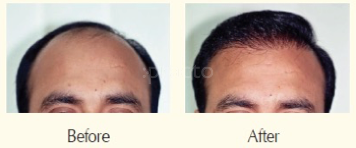 La' Hair Care Clinic Dadar Mumbai