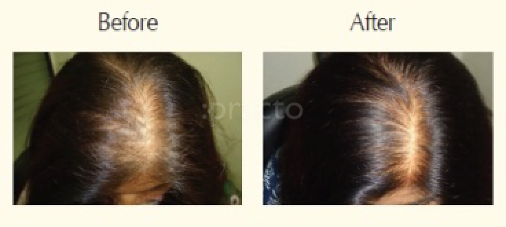 La' Hair Care Clinic Dadar Mumbai