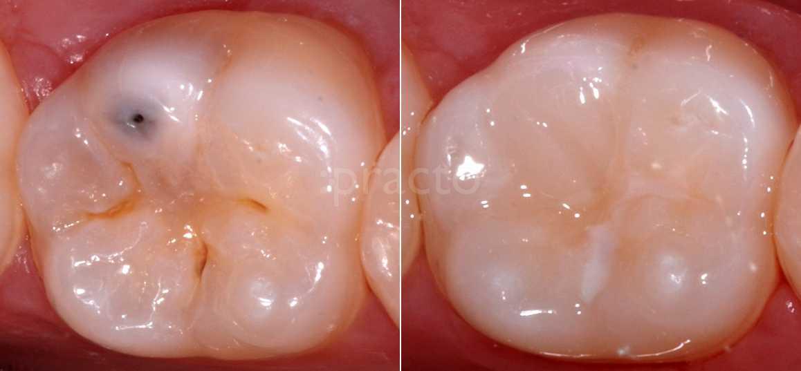 Narayan Dental Clinic Ghatlodia Ahmedabad