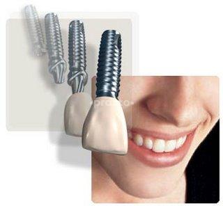 Mumbai Dental & Implant Centre