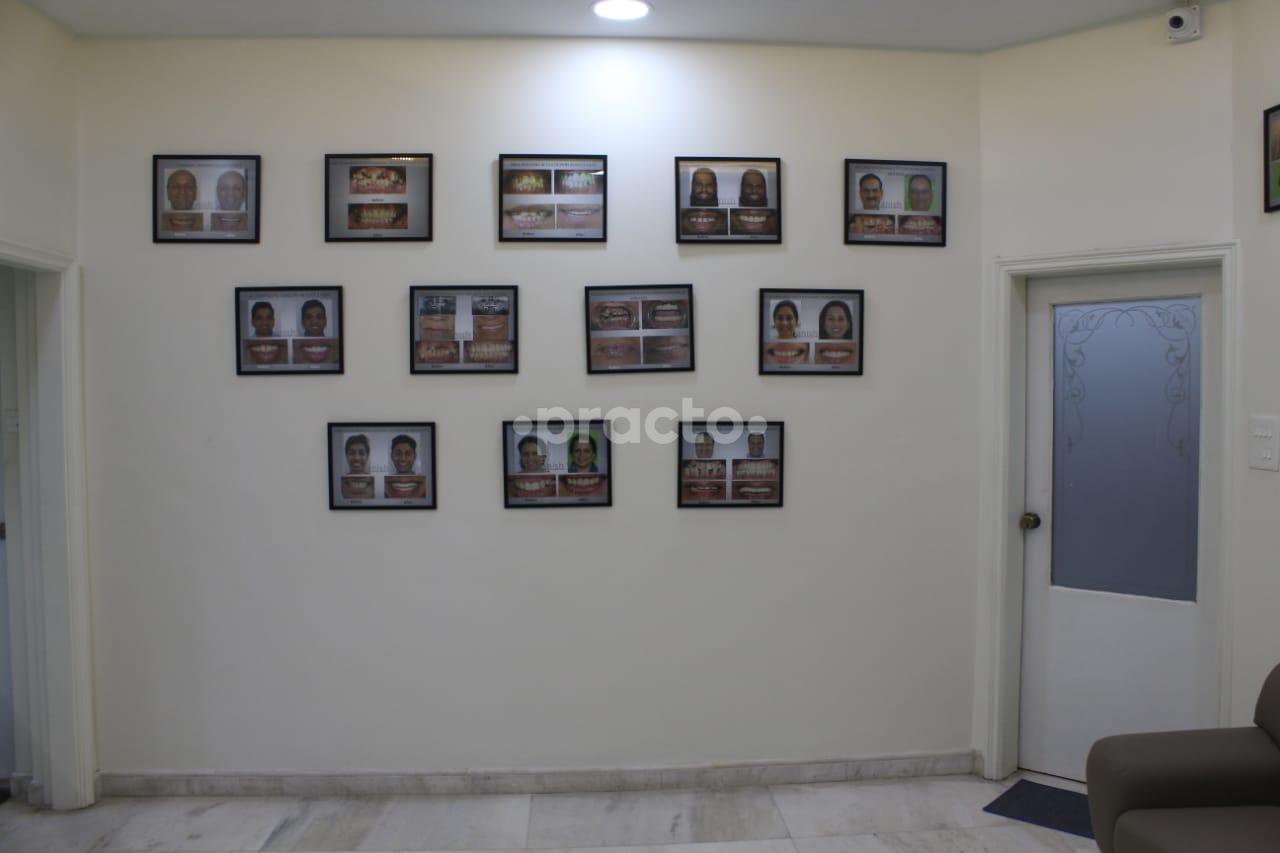 Others at Regal Dental care Koregaon Park Pune