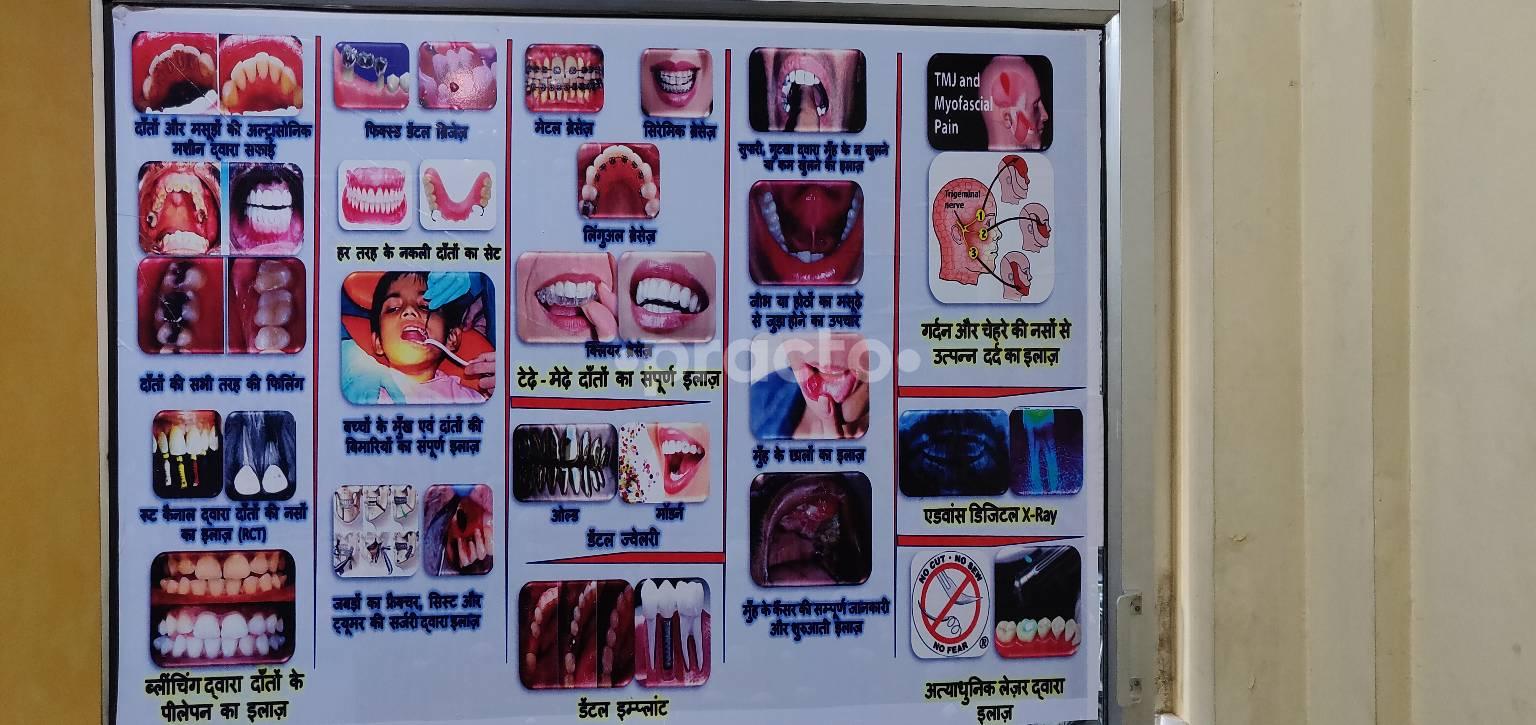 Best Dentist Gorakhpur | Quality Dental Cares Allahadadpur Gorakhpur
