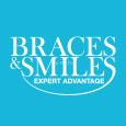 Braces & Smiles