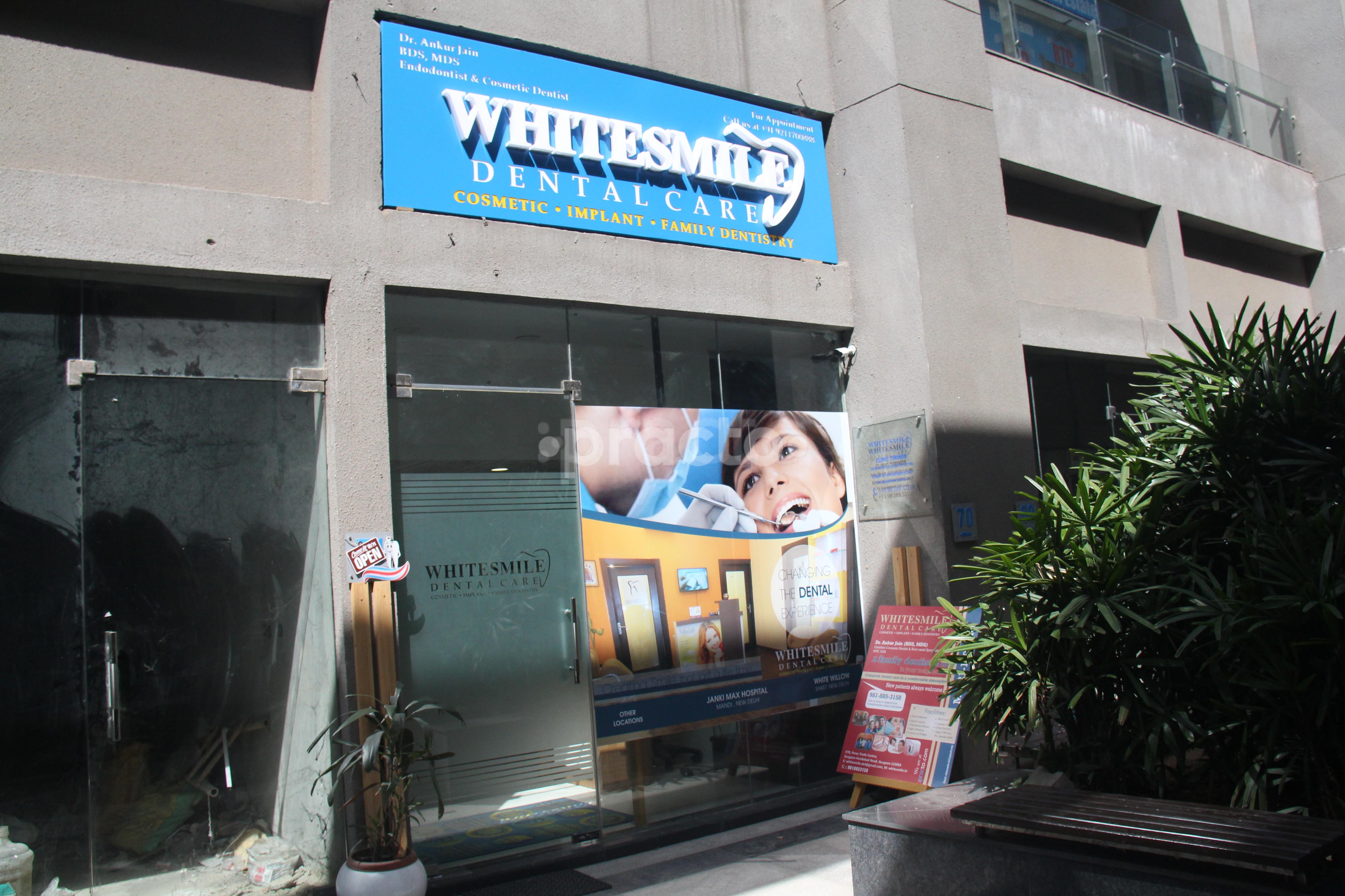 White Smile DLF Phase I Gurgaon