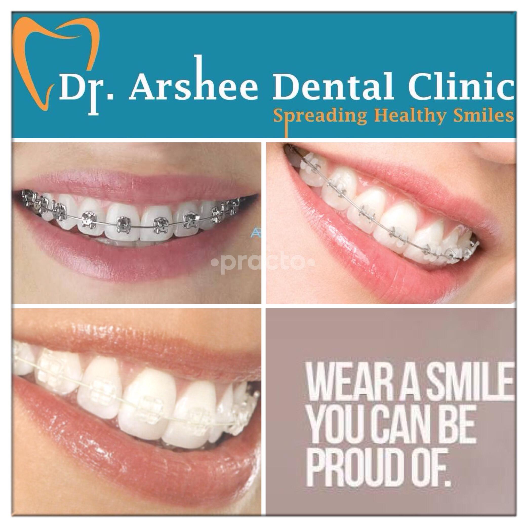 Get Rid of permanent tooth prosthesis For Good permanent tooth prosthesis Is Essential For Your Success. Read This To Find Out Why