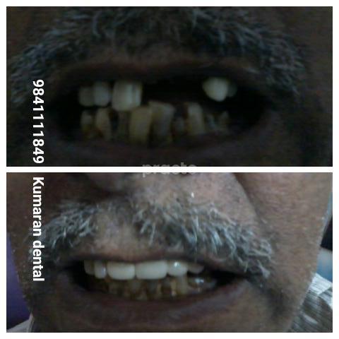 Waiting Area at Kumaran Multispeciality Dental Clinic Keelkattalai Chennai