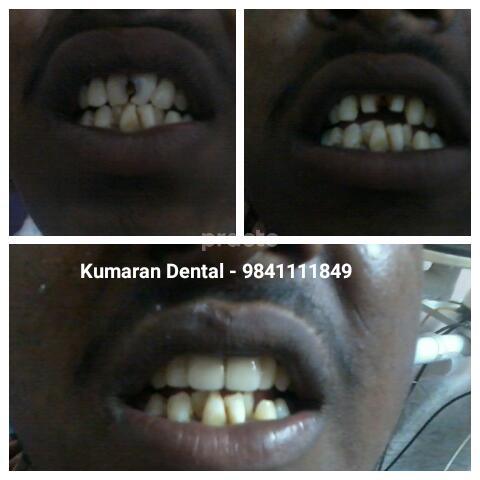 Waiting Area at Kumaran Multispeciality Dental Clinic Keelkattalai Chennai
