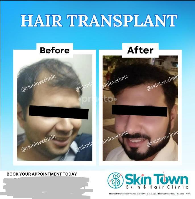 Skin Town Clinic Matunga West Mumbai