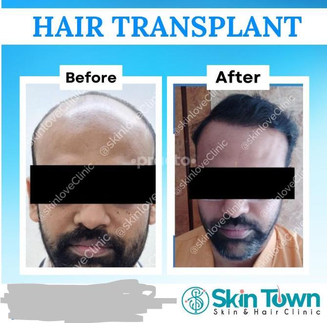 Skin Town Clinic Matunga West Mumbai