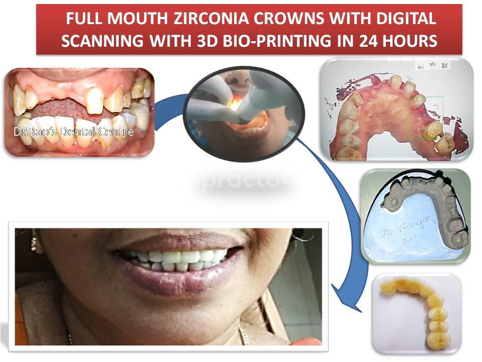 Marketing Sticker at Dr. Rao's Dental Centre ® JP Nagar Bangalore