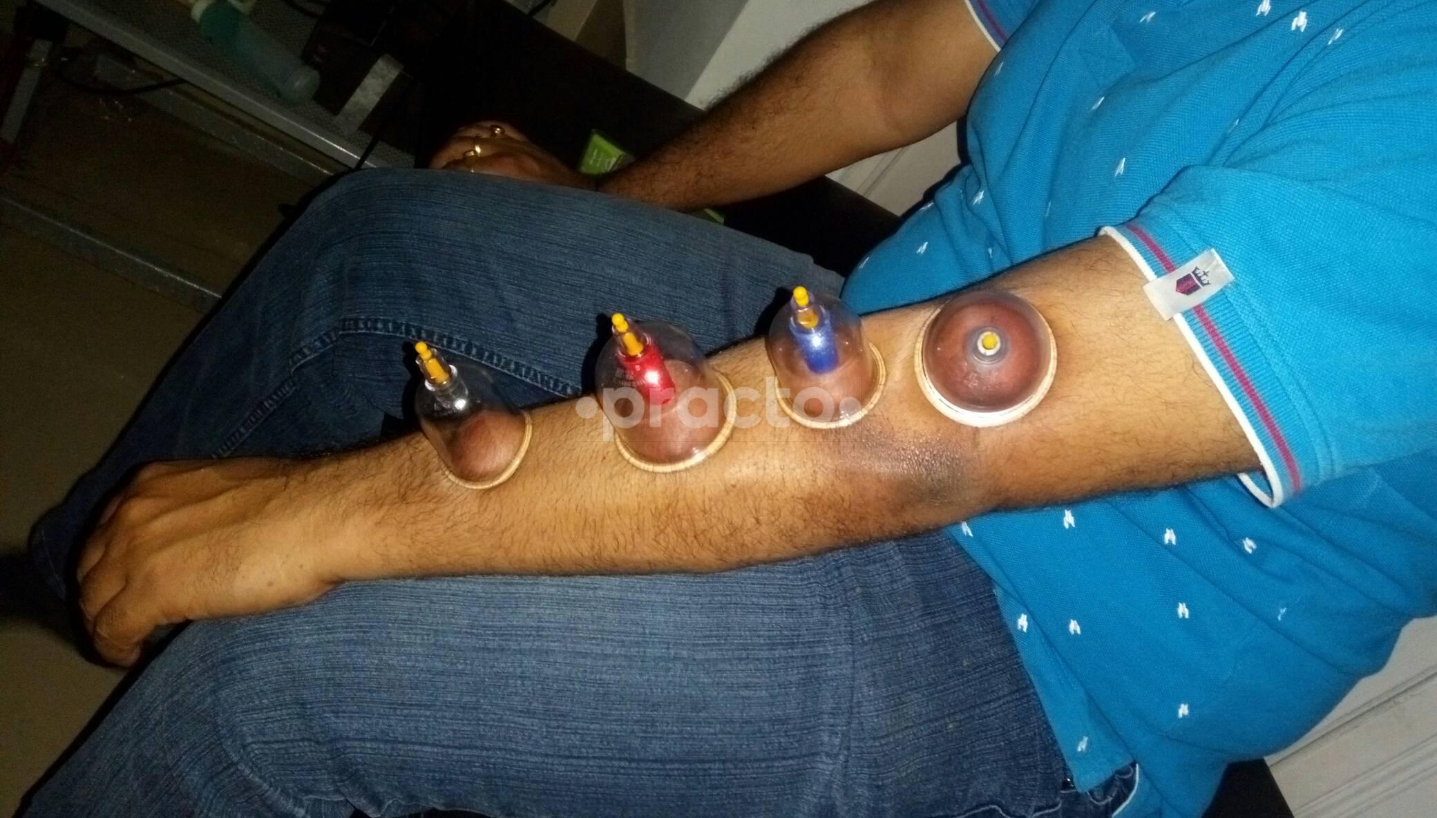 Physiomatix Physiotherapy Clinic Koramangala 6 Block Bangalore