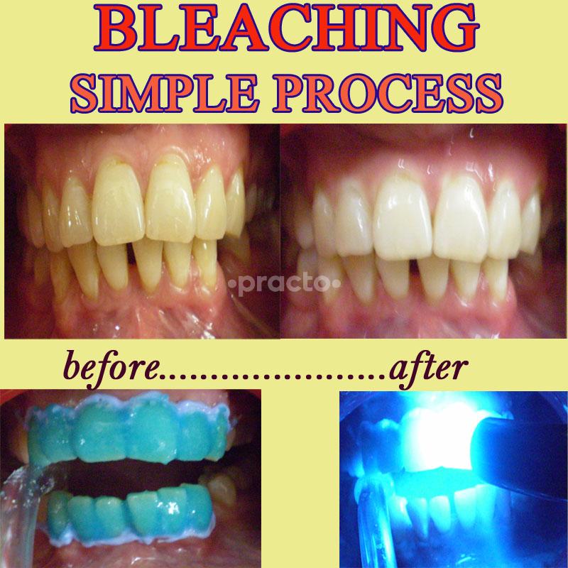 Others at Modern Dental Centre Gurgaon Sector 31 Gurgaon