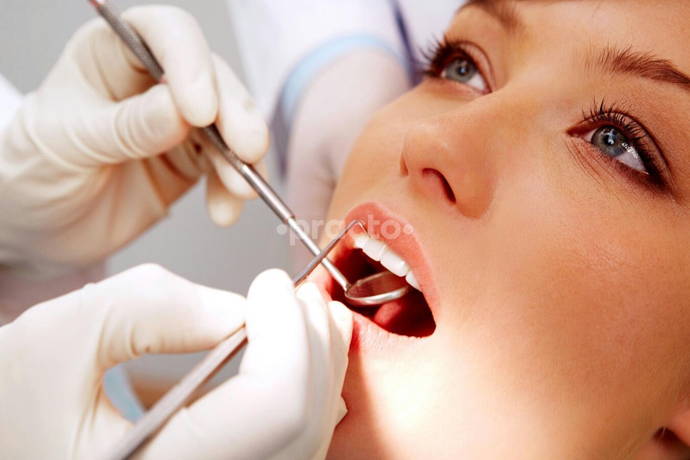 Dental Pearls