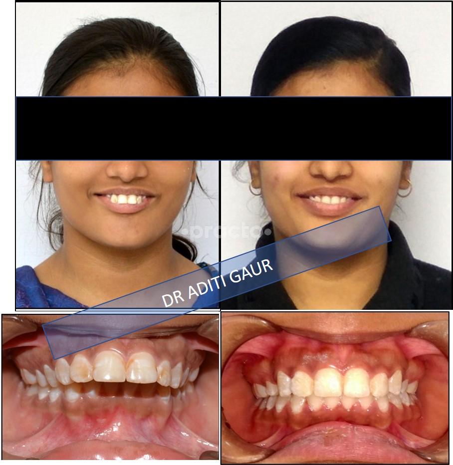 Services at Dental Clinic Mulund West Mumbai
