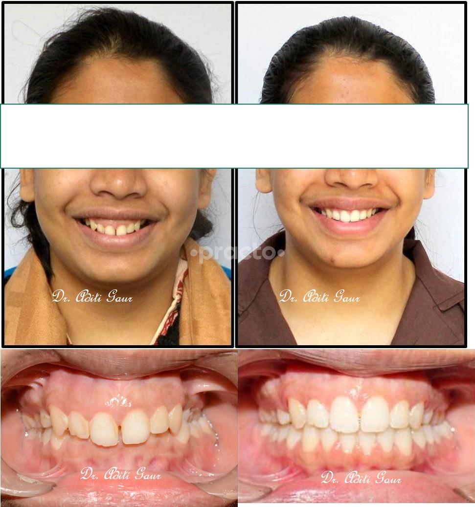 Services at Dental Clinic Mulund West Mumbai