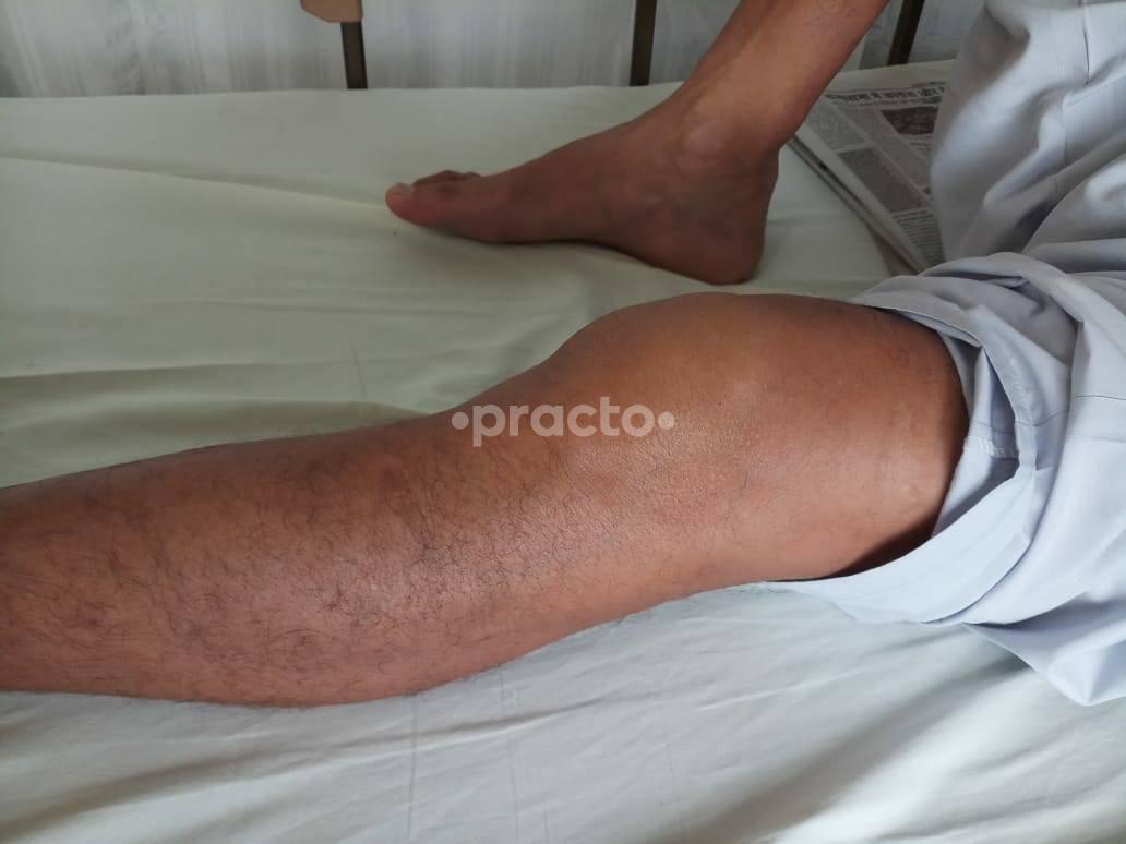 Knee And Hip Joint Clinic Patparganj Delhi