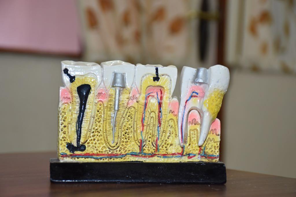 Others at Smile Dental Care Andheri East Mumbai