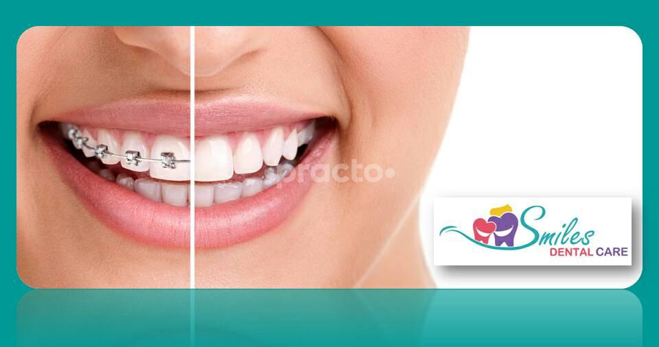 Smiles Dental Care Peenya Bangalore