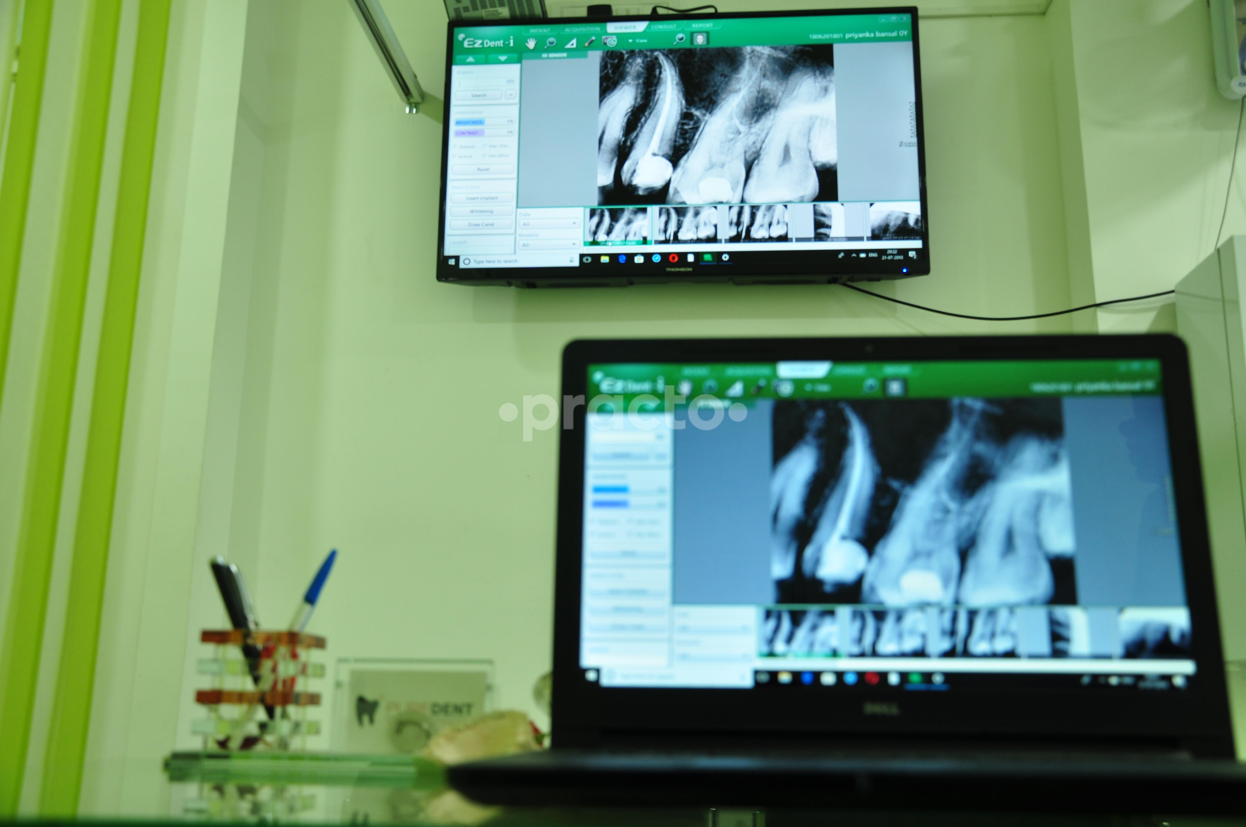 OPD/Ward at Puredent Dental Clinic BTM Layout Bangalore