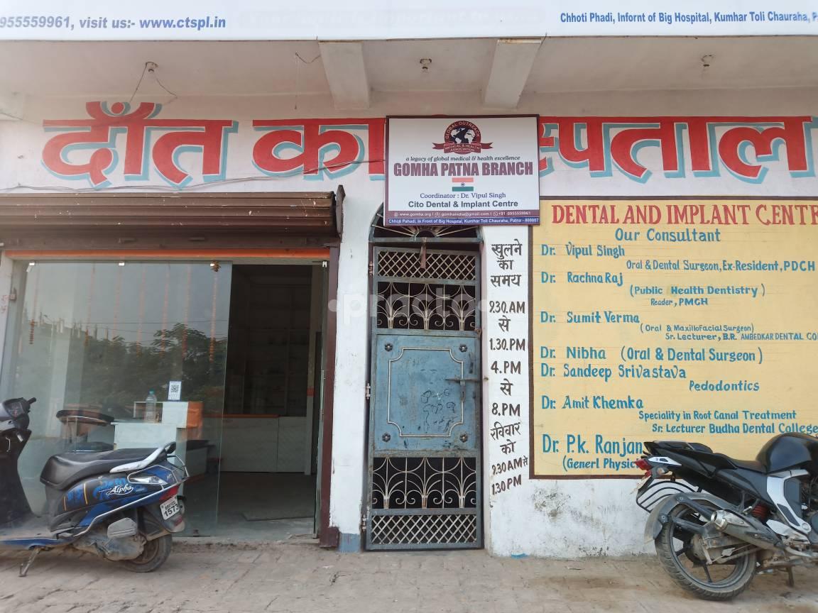 Dental And Implant Centre Kumhrar Patna