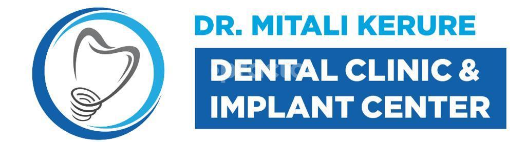 Dr Mitali Kerure Dental Clinic & Implant Center