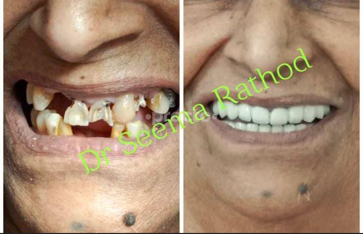 Other at DentHeal Family Dental Care Balewadi Pune
