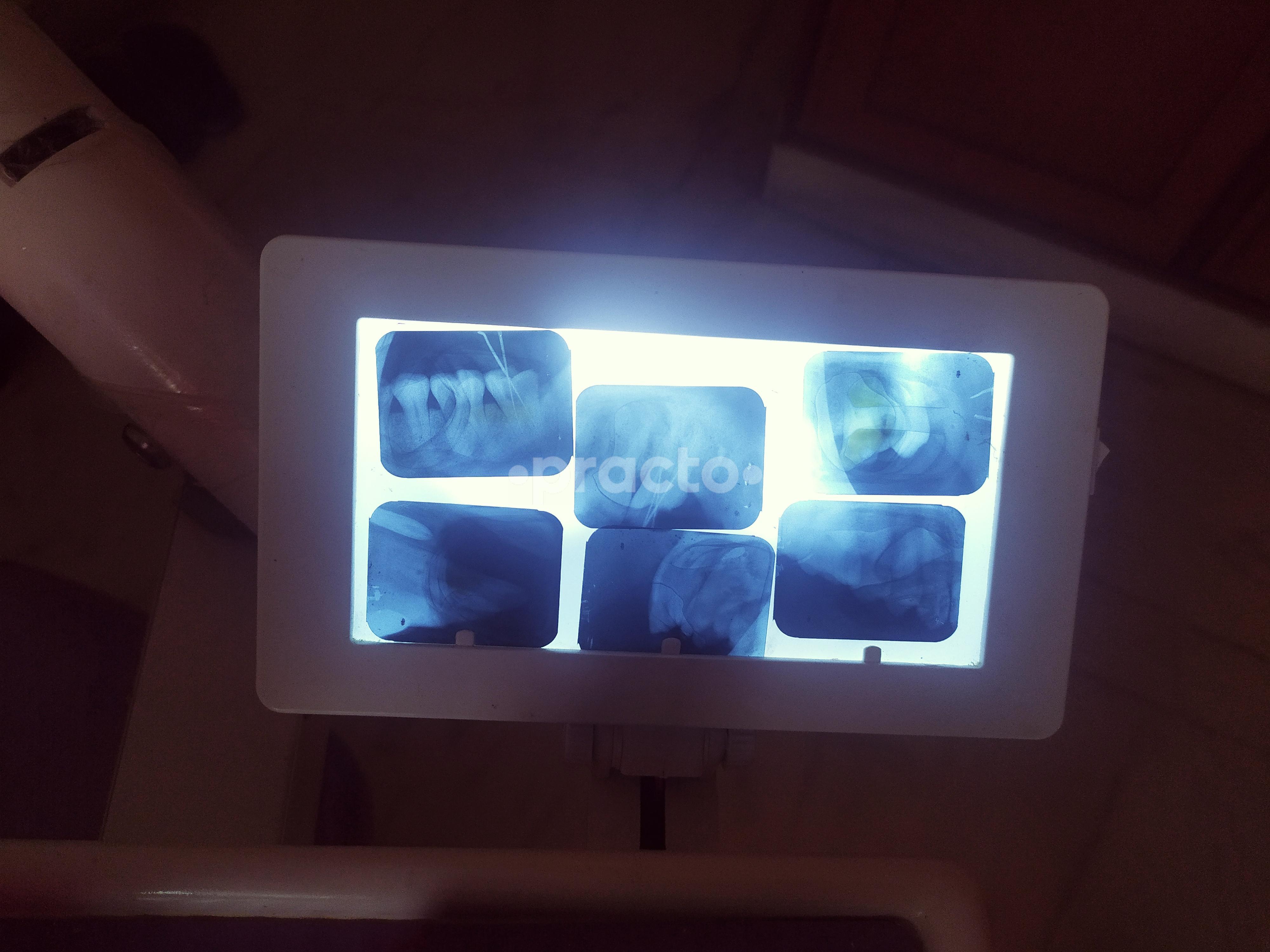 Sample Collection Area at Expert Dental Care Padmanabhanagar Bangalore