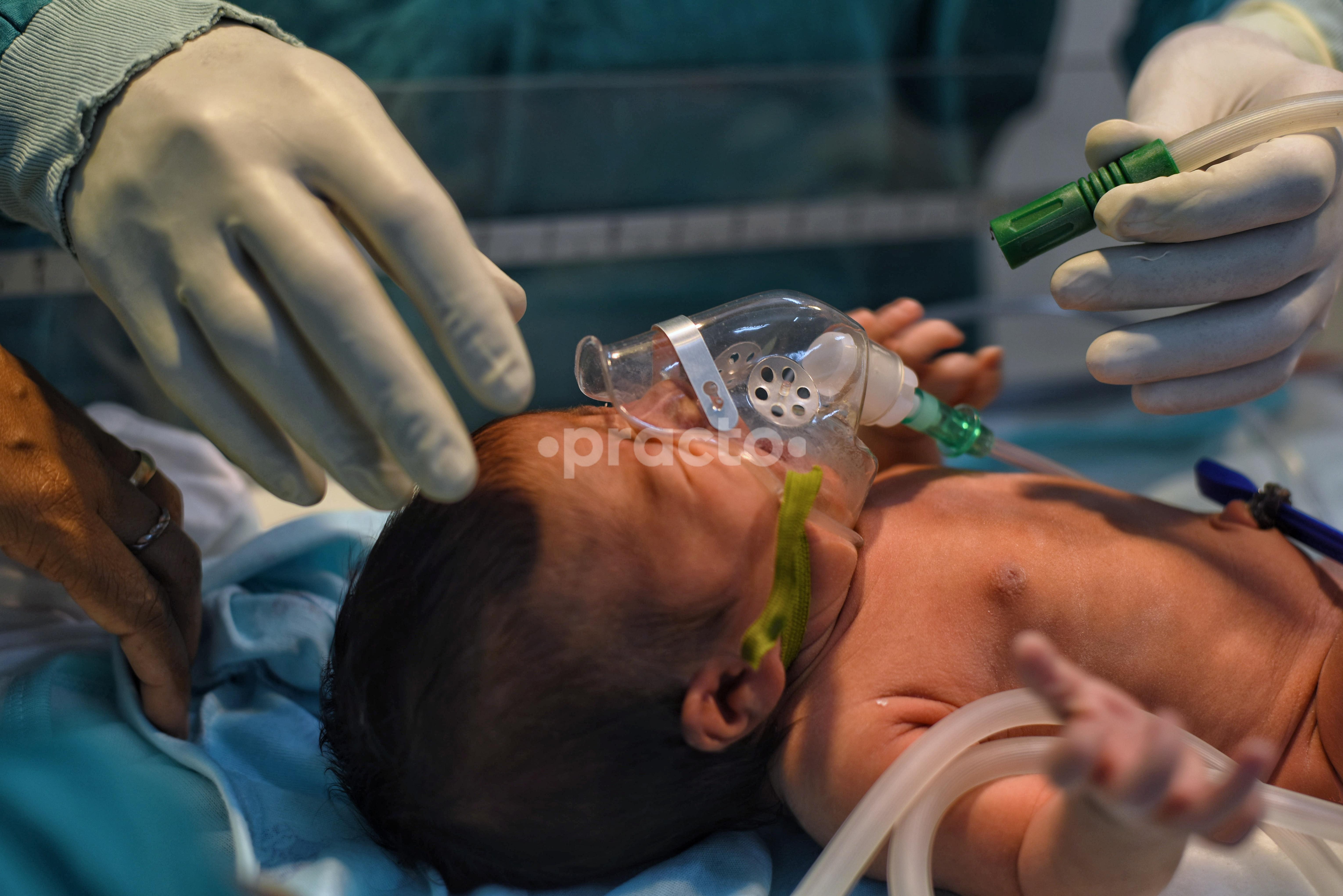 Neonatal Unit at Jain Multispeciality Hospital Shalimar Bagh Delhi