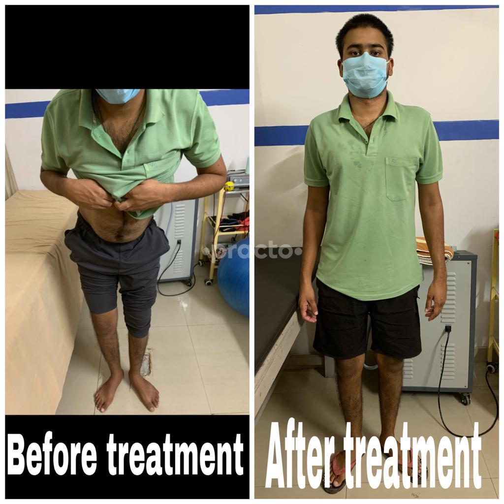 Services at Neuron Physiotherapy Vaishali Nagar Jaipur